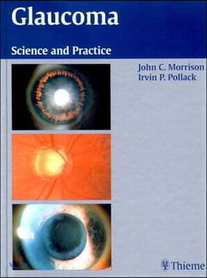 Glaucoma: Science and Practice