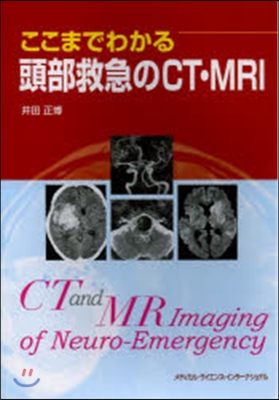 ここまでわかる頭部救急のCT.MRI