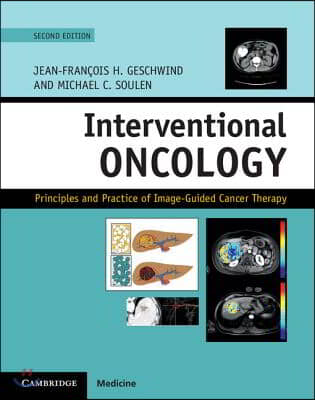 Interventional Oncology: Principles and Practice of Image-Guided Cancer Therapy