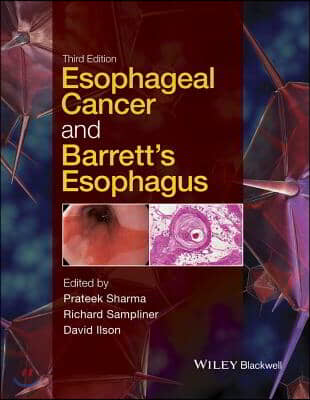 Esophageal Cancer and Barrett&#39;s Esophagus