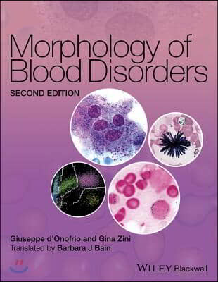 Morphology of Blood Disorders