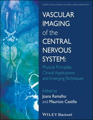 Vascular Imaging of the Central Nervous System: Physical Principles, Clinical Applications, and Emerging Techniques