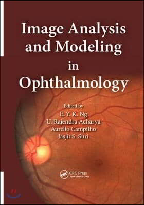 Image Analysis and Modeling in Ophthalmology