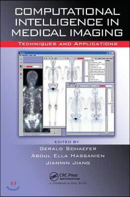 Computational Intelligence in Medical Imaging