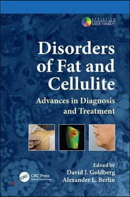 Disorders of Fat and Cellulite