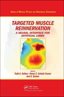 Targeted Muscle Reinnervation