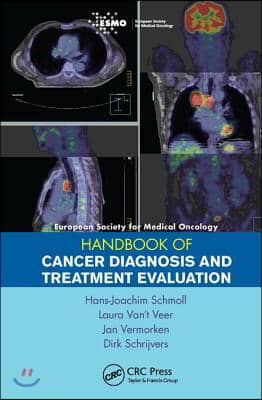 ESMO Handbook of Cancer Diagnosis and Treatment Evaluation