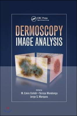 Dermoscopy Image Analysis