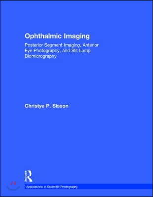 Ophthalmic Imaging