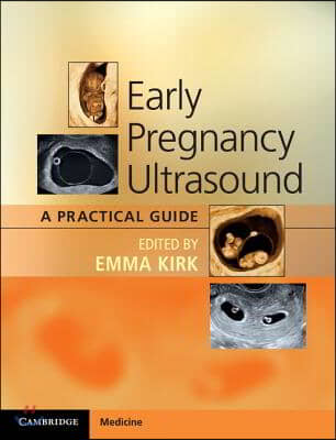 Early Pregnancy Ultrasound: A Practical Guide