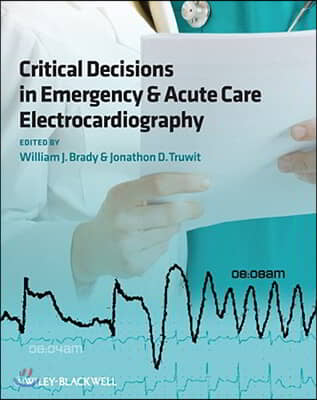 Critical Decisions in Emergency and Acute Care Electrocardiography