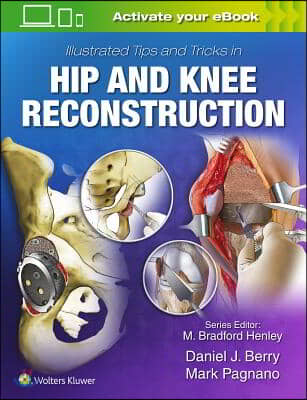 Illustrated Tips and Tricks in Hip and Knee Reconstructive and Replacement Surgery