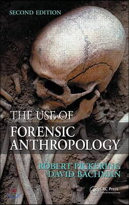 Use of Forensic Anthropology