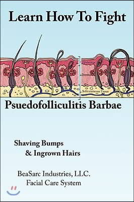 Learn How To Fight Psuedofolliculitis Barbae: Shaving Bumps &amp; Ingrown Hairs