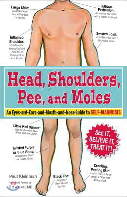 Head, Shoulders, Pee, and Moles: An Eyes-And-Ears-And-Mouth-And-Nose Guide to Self-Diagnosis