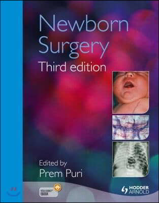 Newborn Surgery