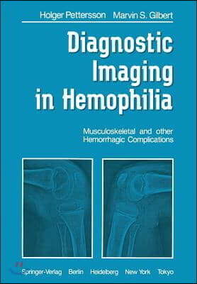 Diagnostic Imaging in Hemophilia: Musculoskeletal and Other Hemorrhagic Complications