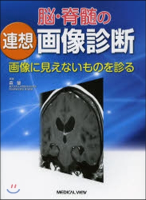 腦.脊髓の連想畵像診斷－畵像に見えないも