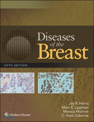 Diseases of the Breast 5e