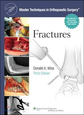 Fractures