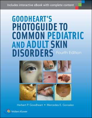 Goodheart&#39;s Photoguide to Common Pediatric and Adult Skin Disorders