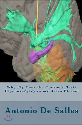 Why Fly Over the Cuckoo's Nest? Psychosurgery in my Brain Please!