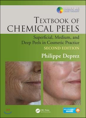 Textbook of Chemical Peels