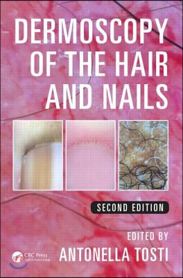 Dermoscopy of the Hair and Nails