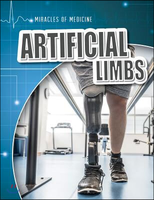 Artificial Limbs