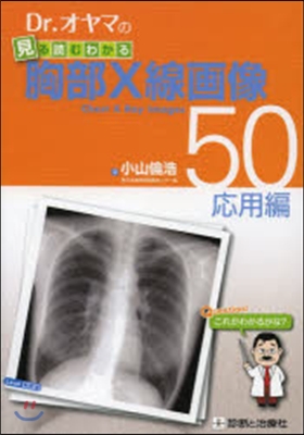 胸部X線畵像50 應用編