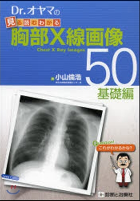 胸部X線畵像50 基礎編