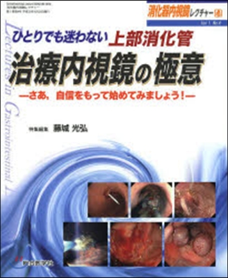 上部消化管治療內視鏡の極意－さあ，自信を