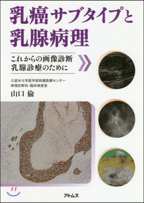 乳癌サブタイプと乳腺病理 これからの畵像