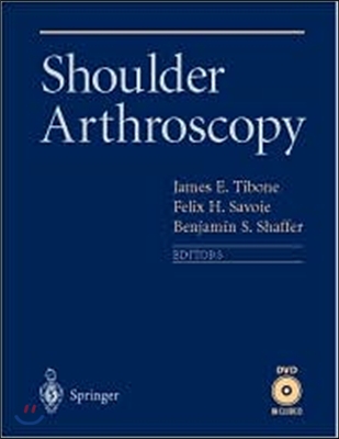 Shoulder Arthroscopy