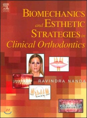 Biomechanics and  Esthetic Strategies in Clinical Orthodontics
