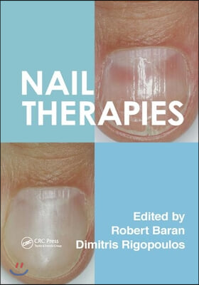 Nail Therapies