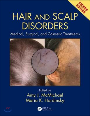 Hair and Scalp Disorders