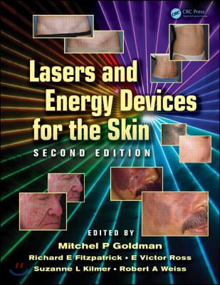 [중고-최상] Lasers and Energy Devices for the Skin