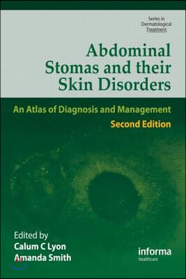 Abdominal Stomas and Their Skin Disorders