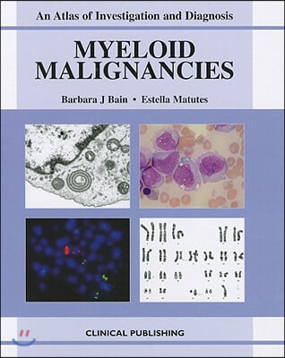 Myeloid Malignancies