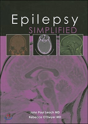 Epilepsy Simplified