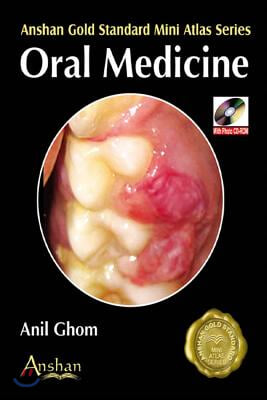 Oral Medicine [With CDROM]