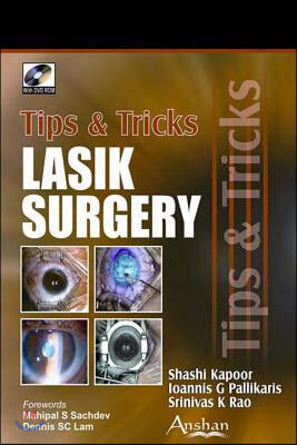 Lasik Surgery