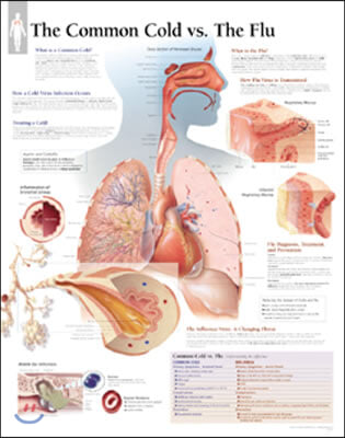 Common Cold vs the Flu Laminated Poster