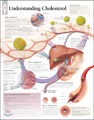 Understanding Cholesterol Laminated Poster