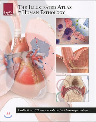 Illustrated Atlas of Human Pathology