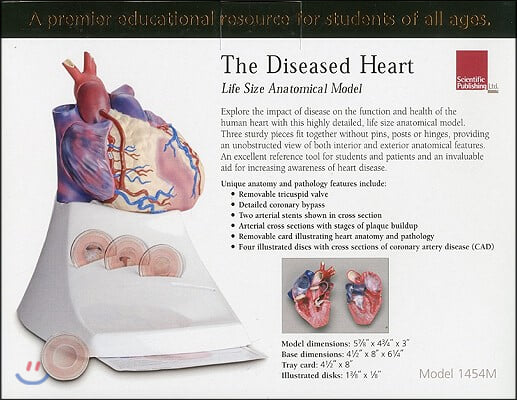 Life Size Diseased Heart Model