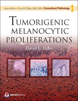 Tumorigenic Melanocytic Proliferations