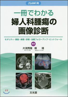 一冊でわかる婦人科腫瘍の畵像診斷