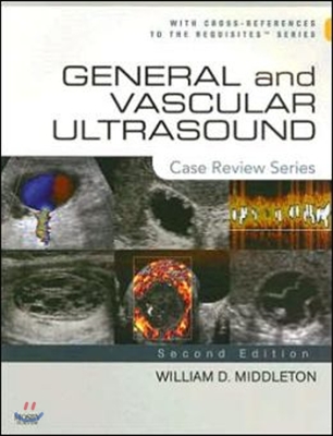 General And Vascular Ultrasound